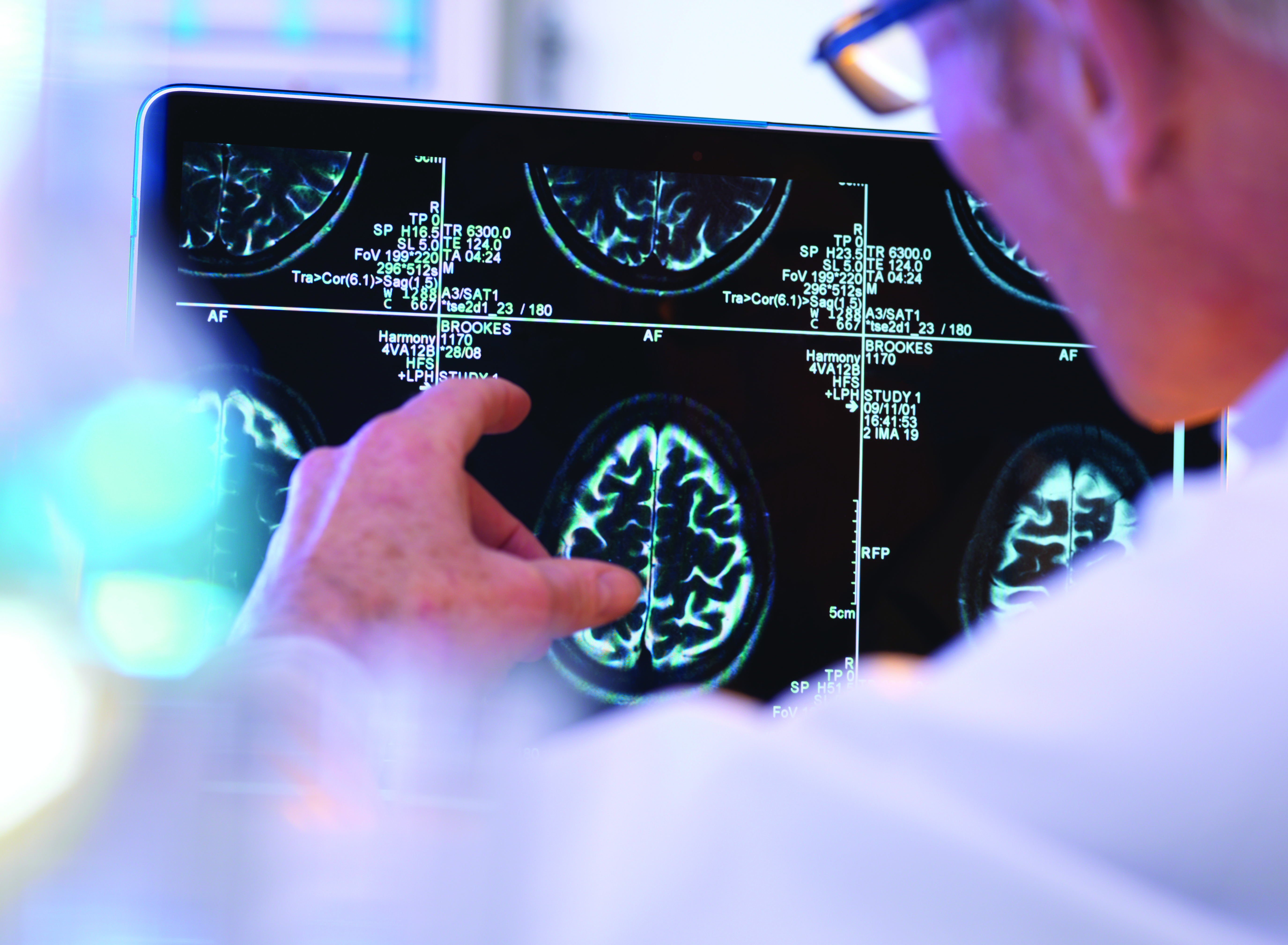 doctor pointing to an MRI machine, reading a neurological MRI